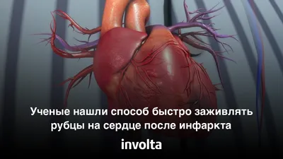 Рубцы на сердце: Ученые раскрыли тайну внезапной смерти: читать на Golos.ua