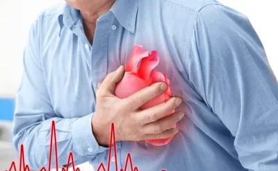 Что такое инфаркт миокарда? Инфаркт миокарда: причины, первые признаки,  методы лечения и профилактики