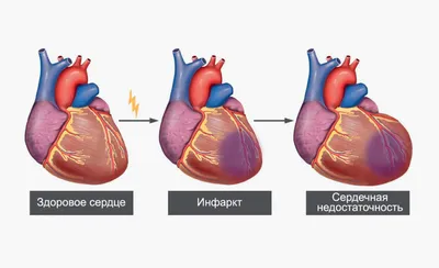 Найден способ полностью восстановить сердце после инфаркта - 30.09.2019,  Sputnik Таджикистан