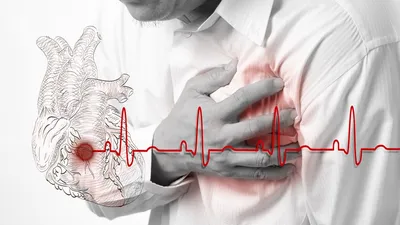Инфаркт миокарда у пожилых – признаки, причины, первая помощь