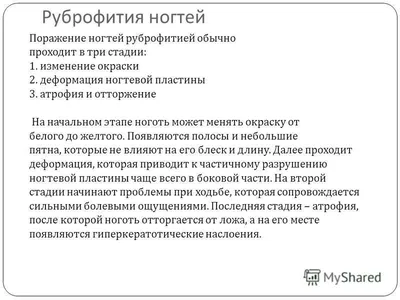 Уральск Маникюр Педикюр on Instagram: \"10 распространённых заболеваний  которые мы сегодня изучили\"