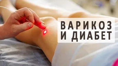 Лечение трофической язвы нижних конечностей в клинике Санкт-Петербурга