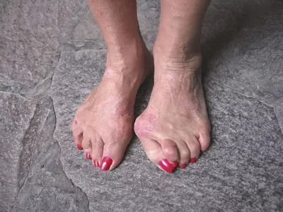 От грязных ног до синих ногтей и волосатых подмышек - спрос на самые  необычные фотографии | Narratoria | Дзен
