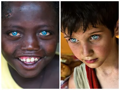 Взгляд не отвести. 10 детей с самыми красивыми глазами на свете