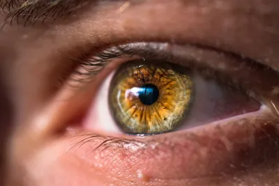 Какой цвет глаз в мире самый редкий