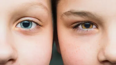 Какой цвет глаз самый редкий в мире | РБК Украина
