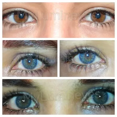 Цвет глаз, какие самые редкие и самые распространенные?