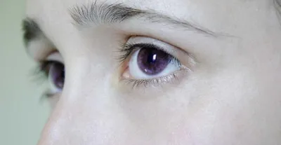 MedPortal - От чего зависит цвет глаз человека