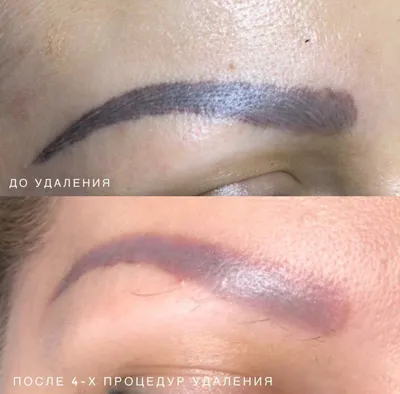 Перманентный макияж бровей в Заречном: 61 мастер по бровям с отзывами и  ценами на Яндекс Услугах.