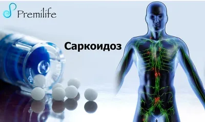 Саркоидоз - диагностика и лечение в 100med