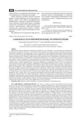 Поражение органа зрения при саркоидозе – тема научной статьи по клинической  медицине читайте бесплатно текст научно-исследовательской работы в  электронной библиотеке КиберЛенинка