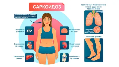 Конъюнктивит, синдром сухого глаза, красный глаз: симптомы, диагностика и  лечение