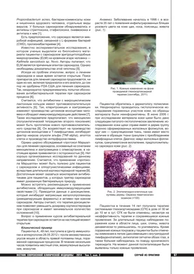 Развитие саркоидоза кожи после проведения перманентного макияжа бровей -  Снарская - Российский журнал кожных и венерических болезней