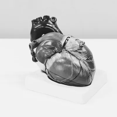 Что такое саркома сердца | Умная Россия