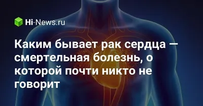 Опухоли сердца - признаки, причины, симптомы, лечение и профилактика -  iDoctor.kz