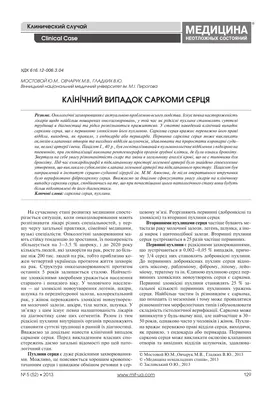 Результаты хирургического лечения первичных сарком сердца | Патология  кровообращения и кардиохирургия