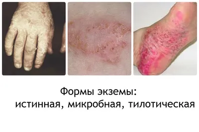 Убрать морщины на лице в Ульяновске — Многопрофильная клиника Н.Березиной  Ульяновск