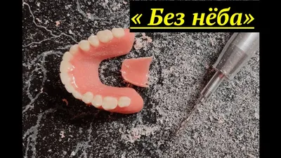 Съёмные БЕЗ нёба существуют? #стоматология #протезированиезубов - YouTube