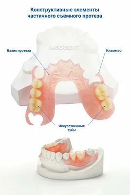 Зубные протезы на присосках в Киеве — лучшие предложения в ЦИС | CIS