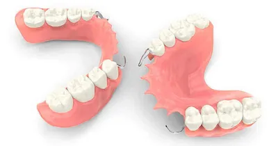 Телескопические съемные зубные протезы для восстановления зубов