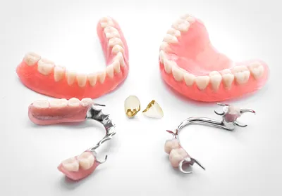 Съемные зубные протезы полной потере зубов в клинике Адалдент
