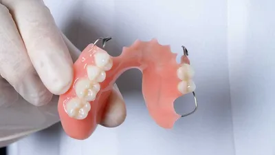 Съёмные протезы | Авторская клиника стоматологии доктора Муссурова