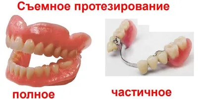 Акриловые съемные протезы для зубов в Омске по низким ценам в стоматологии  Ортодонт-центр