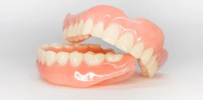 Какие бывают виды зубных протезов?
