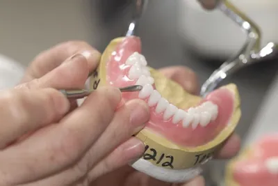 Частичные съемные зубные протезы — цена на один зуб или челюсть ❘ Ортодонт  Комплекс
