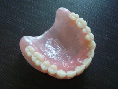 Съемные протезы для челюсти в Астане (Нур-Султан) – Установка съемных  зубных протезов в стоматологии «МЛД»