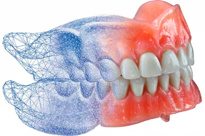 Съемные зубные протезы в Калуге цены