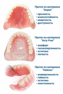 Какие съемные зубные протезы лучше – сравнение видов | «Фактор улыбки»