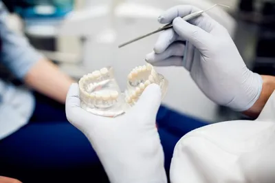 Биомеханика форсированного ортодонтического лечения скученного положения  зубов передней группы при сужении зубных рядов