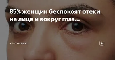 Как убрать мешки под глазами: что помогает, как избавиться, причины  появления, виды лечение и процедур