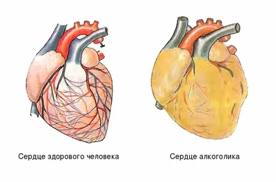 Сердце под угрозой: Как алкоголь влияет на сердечно-сосудистую систему |  Наркологическая клиника \"lifeclinic24\" | Дзен