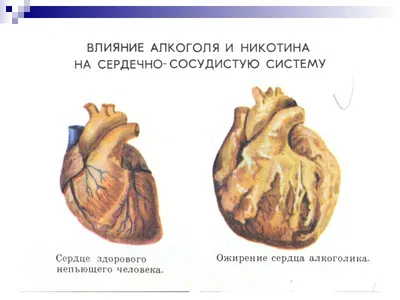 Как распознать алкоголизм - ГУЗ \"ГОРОДСКАЯ ПОЛИКЛИНИКА №1 Г.ГРОДНО\"