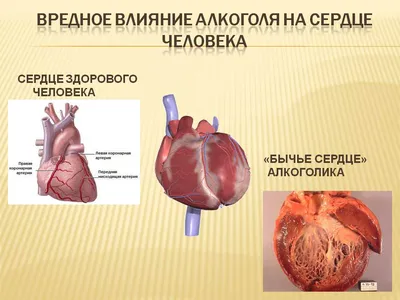 Почему болит сердце после пьянки и что можно сделать в этом случае |  Наркологическая клиника \"lifeclinic24\" | Дзен