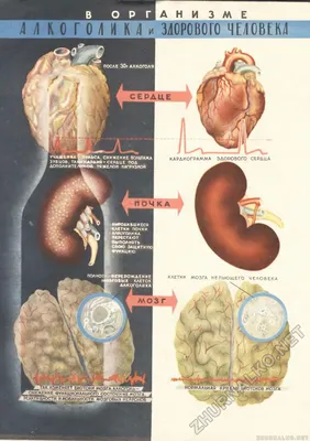 Печень и сердце алкоголика