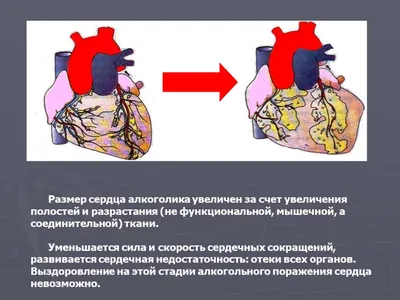 Пивной алкоголизм | Здоровый образ жизни | | Круглянский район | Круглое |  Круглянский райисполком | Новости Круглянского района