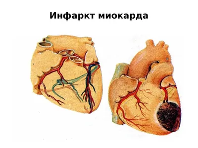 Сегодня 31 мая - Всемирный день без табака -