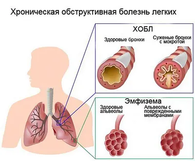 Центр общественного здоровья и медицинской профилактики » Влияние  табакокурения на сердце и сосуды