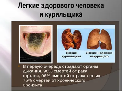 Молодежь Кыргызстана против табака. Youth of Kyrgyzstan against tobacco. -  Влияние курения на сердце ⠀ 🔻Под влиянием никотина сердце курящего человека  за сутки способно сделать на несколько тысяч сокращений больше, чем у