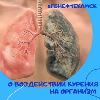 Курить – здоровью вредить | ВКонтакте