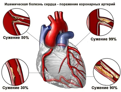 Векторная анатомия легких и иллюстрация заболеваний здоровые легкие и  легкие курящего человека | Премиум векторы