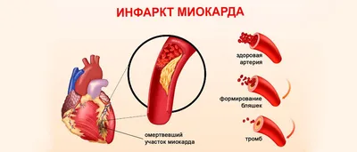 Что такое рубец на сердце? | Анна Кореневич | Врач-кардиолог | Клинический  психолог | Дзен