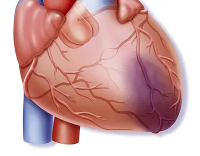 Защищают сердечную мышцу»: учёные выявили связь между приёмом пробиотиков и  скоростью восстановления после инфаркта — РТ на русском