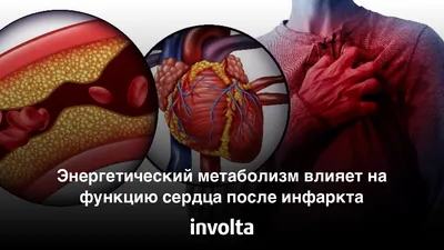 Диетотерапия после инфаркта миокарда – тема научной статьи по ветеринарным  наукам читайте бесплатно текст научно-исследовательской работы в  электронной библиотеке КиберЛенинка