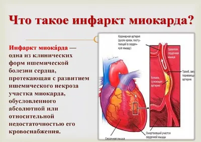 Инфаркт, когда ты еще молодой. Истории белорусов