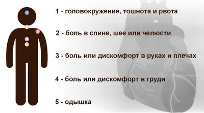 Экстренные операции при инфаркте миокарда - Инновационный сосудистый центр  - ИСЦ