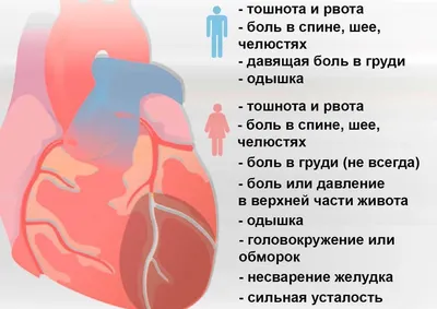 Инфаркт миокарда: как выглядит, что значит инфаркт сердца